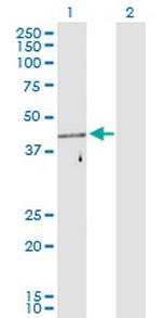 FEZ1 Antibody in Western Blot (WB)