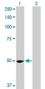 PPM1F Antibody in Western Blot (WB)