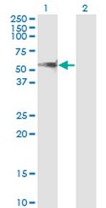 PPM1F Antibody in Western Blot (WB)