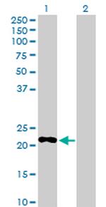 PDE4DIP Antibody in Western Blot (WB)