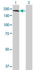 HISPPD2A Antibody in Western Blot (WB)