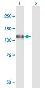 N4BP1 Antibody in Western Blot (WB)