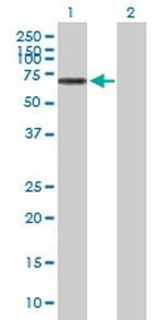 NOS1AP Antibody in Western Blot (WB)