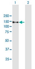 ZFYVE16 Antibody in Western Blot (WB)