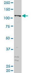 ZFYVE16 Antibody in Western Blot (WB)