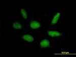 RAPGEF5 Antibody in Immunocytochemistry (ICC/IF)