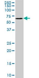 RAPGEF5 Antibody in Western Blot (WB)