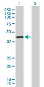 PTDSS1 Antibody in Western Blot (WB)