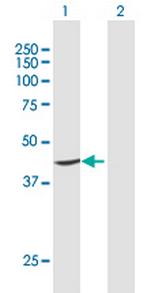 PTDSS1 Antibody in Western Blot (WB)