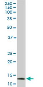 TOMM20 Antibody in Western Blot (WB)