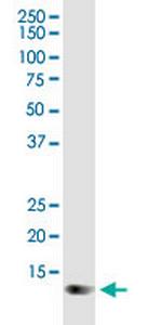 TOMM20 Antibody in Western Blot (WB)