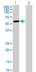 IHPK1 Antibody in Western Blot (WB)