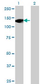 RNF40 Antibody in Western Blot (WB)