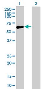 GIT2 Antibody in Western Blot (WB)