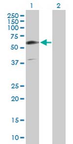 GIT2 Antibody in Western Blot (WB)