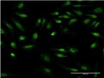 GIT2 Antibody in Immunocytochemistry (ICC/IF)