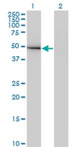 GIT2 Antibody in Western Blot (WB)