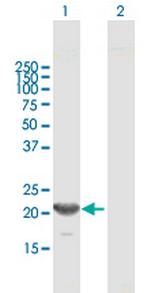 GINS1 Antibody in Western Blot (WB)