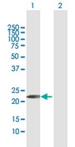 GINS1 Antibody in Western Blot (WB)