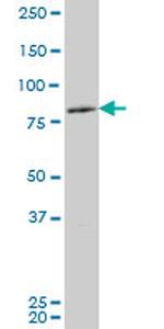 ZFHX1B Antibody in Western Blot (WB)