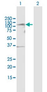 TLK1 Antibody in Western Blot (WB)