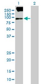 SV2B Antibody in Western Blot (WB)