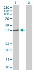 LPGAT1 Antibody in Western Blot (WB)