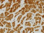 MFN2 Antibody in Immunohistochemistry (Paraffin) (IHC (P))