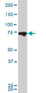 MFN2 Antibody in Western Blot (WB)