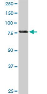 MFN2 Antibody in Western Blot (WB)