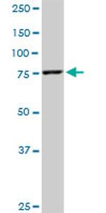 MFN2 Antibody in Western Blot (WB)