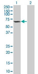 OXSR1 Antibody in Western Blot (WB)