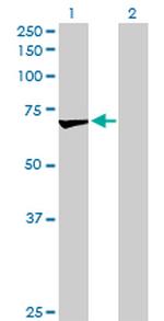 OXSR1 Antibody in Western Blot (WB)