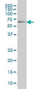 OXSR1 Antibody in Western Blot (WB)