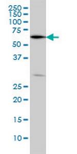 OXSR1 Antibody in Western Blot (WB)