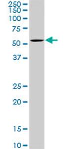 OXSR1 Antibody in Western Blot (WB)