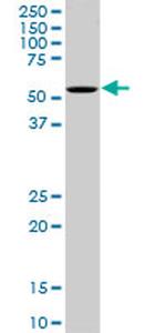 OXSR1 Antibody in Western Blot (WB)