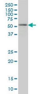 OXSR1 Antibody in Western Blot (WB)