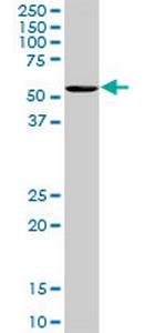 OXSR1 Antibody in Western Blot (WB)