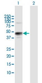 HS3ST3A1 Antibody in Western Blot (WB)