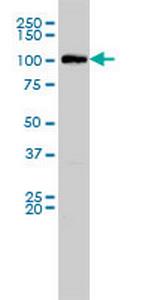 MVP Antibody in Western Blot (WB)