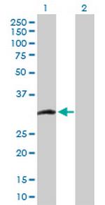 CCS Antibody in Western Blot (WB)