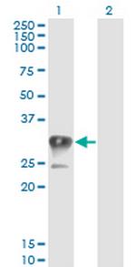 CCS Antibody in Western Blot (WB)