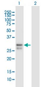 SCO2 Antibody in Western Blot (WB)