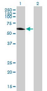 AKT3 Antibody in Western Blot (WB)