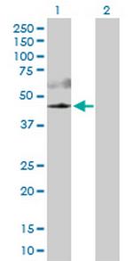 AKT3 Antibody in Western Blot (WB)