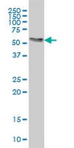 AKT3 Antibody in Western Blot (WB)