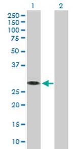 MED6 Antibody in Western Blot (WB)