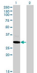 MED6 Antibody in Western Blot (WB)