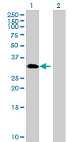 GNPDA1 Antibody in Western Blot (WB)